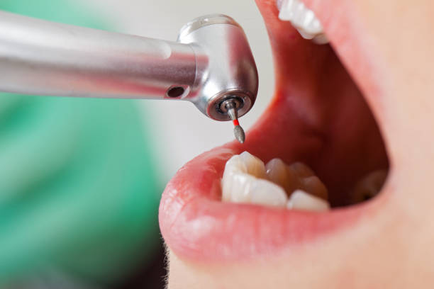 Best Root Canal Emergency Dentist  in Livonia, LA